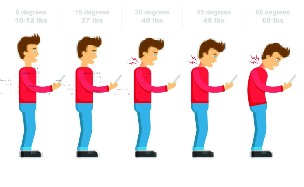 Illustration showing how increasing neck tilt while using a smartphone raises strain on the cervical spine, leading to neck pain.